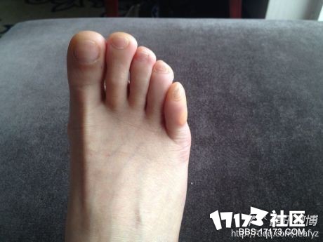 你是希腊脚吗··是希腊脚的不是美就是帅 反正我是 有照片